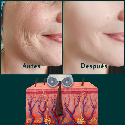 Mini Masajeador Facial de Microcorriente